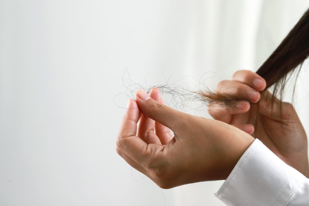 Hair Fall Control Treatment in Hyderabad