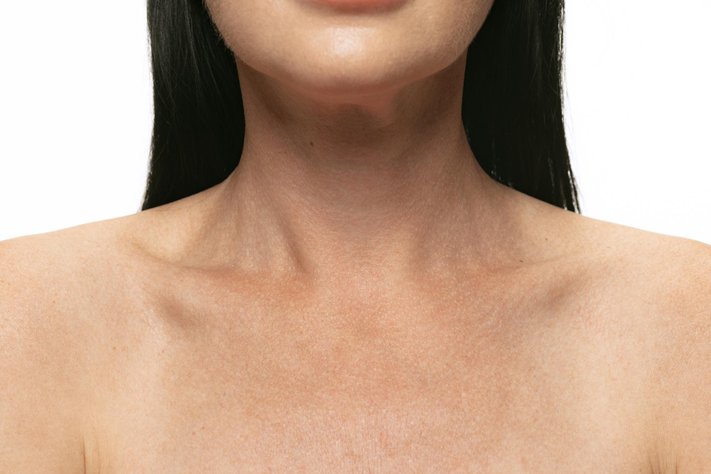 Pigmentation Treatment for the Neck in hyderabad